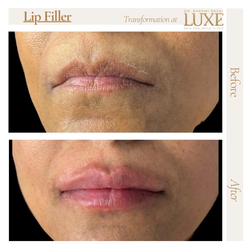 WhatsApp Image 2025-06-02 at 18.23.33_9aed0402